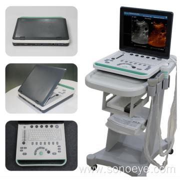 Laptop Ultrasound System With Trolley B